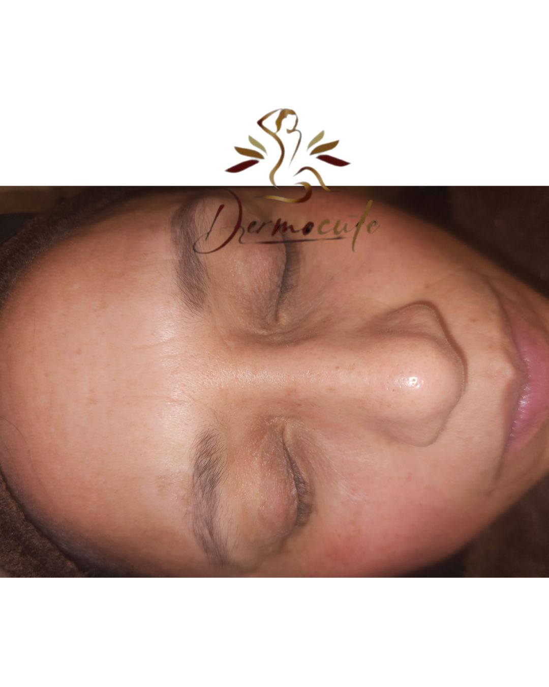 Tratamiento integral no invasivo